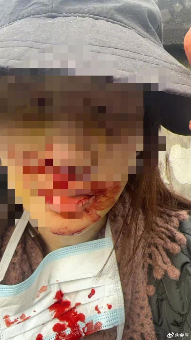 ר�ý�__�𳿰���