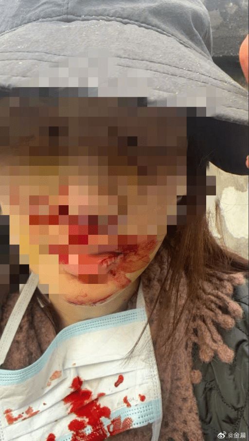 �𳿾ͽ�ͨ�¹���Ǹ����̷�ʡ�����һ�������ϸ����ؽ�ͨ����