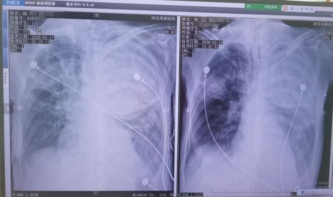 ���ļ�������__����������֢����