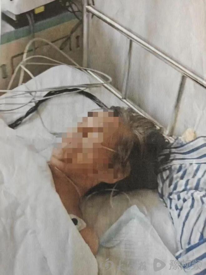 �ӱ�һ67������Ƥ����ȾסԺ������