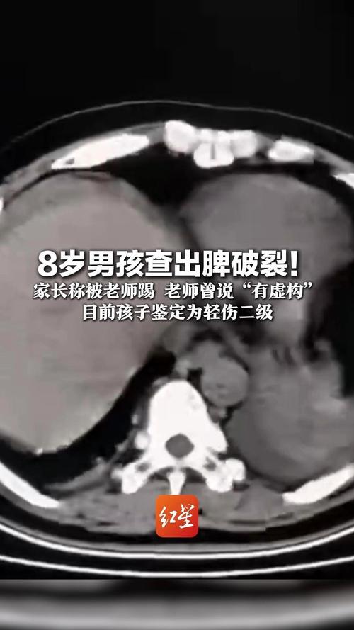 _Ƣ����ȷ��_Ƣ���ѷ�ҽ����������ʲô��