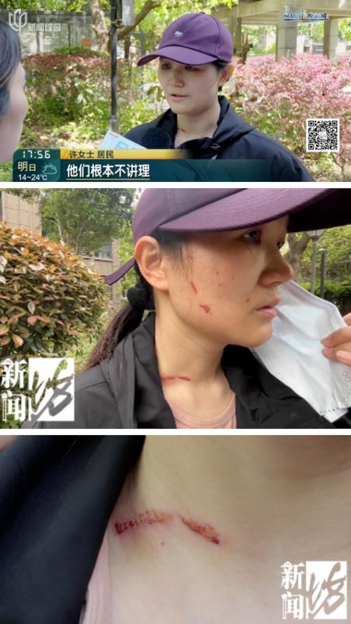 _����ì�ܴ��_�ھ�ì�ܴ�ܿ��Ծ�����